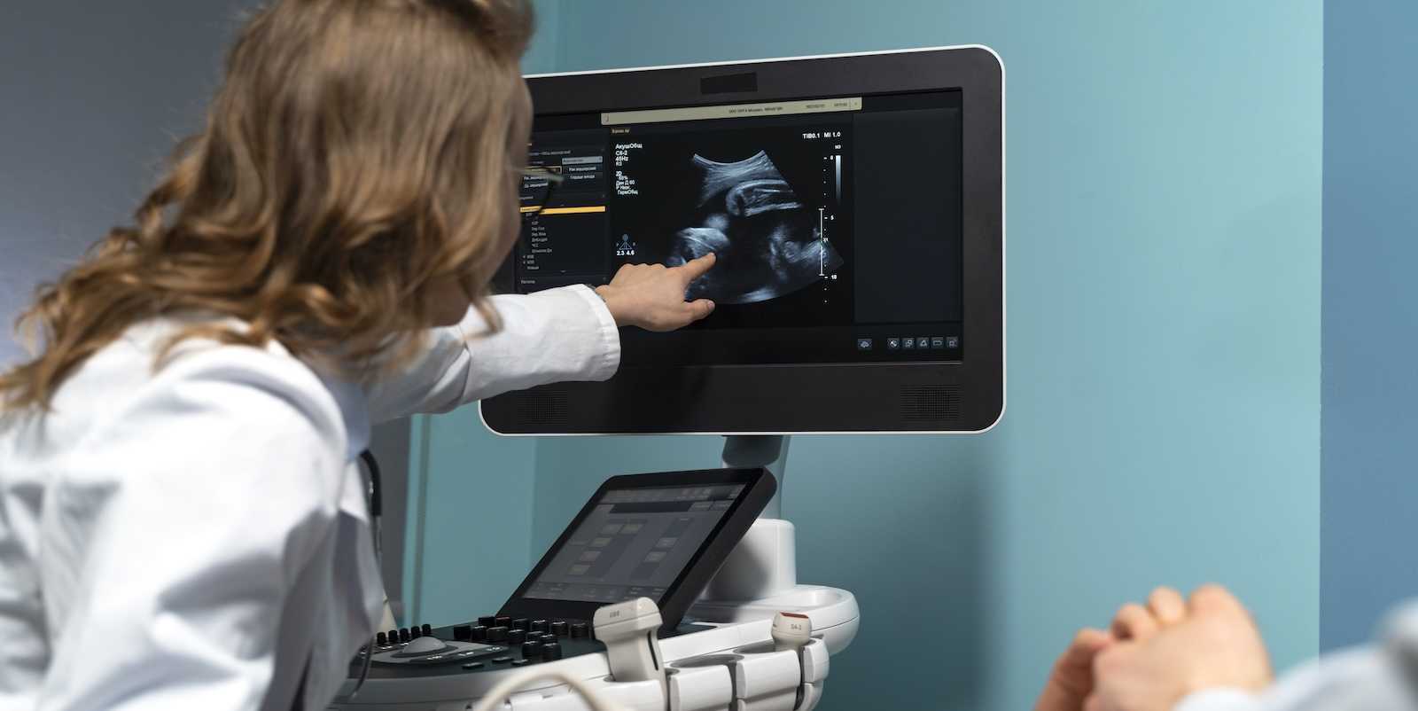 MI-támogatást engedélyezett magzati ultrahang-vizsgálatokhoz az FDA